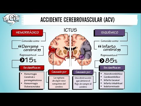 Tipos De Infarto Cerebral • TIPOSDE