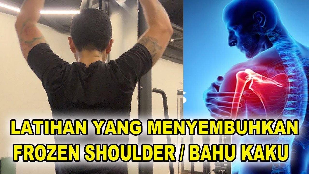 menyembuhkan-frozen-shoulder-bahu-kaku-youtube