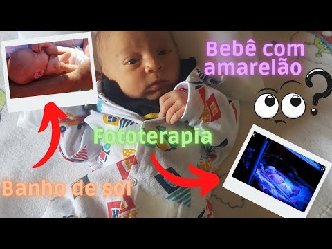 icterícia mais conhecida como amarelão em recém-nascido / tipos de ...