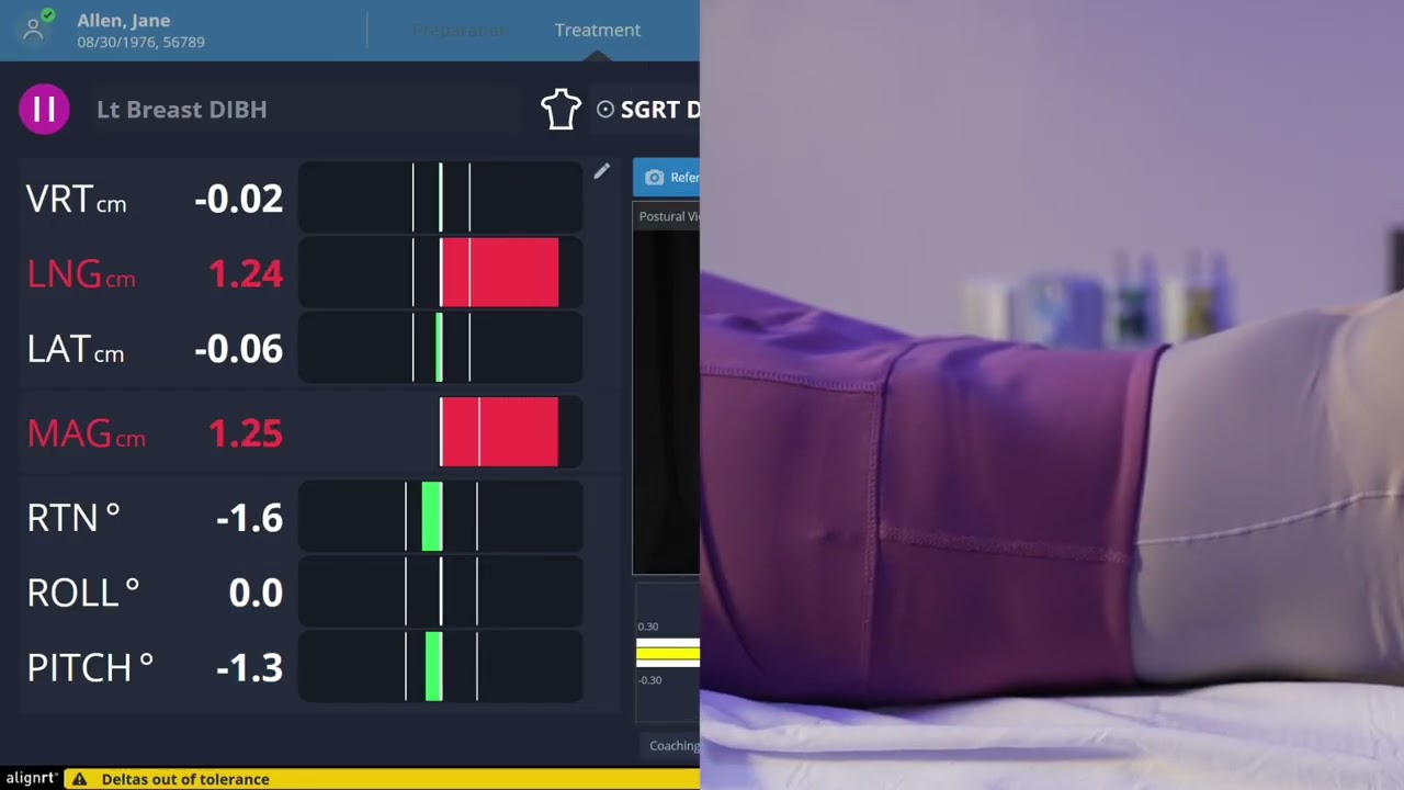 AlignRT: DIBH Workflow