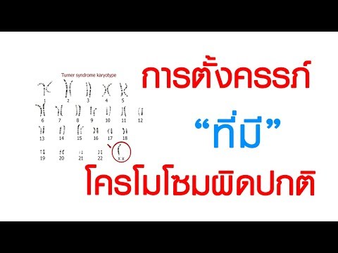 พบหมอเสรี ตอนที่ 88 : การตั้งครรภ์ที่ทารกในครรภ์มีโครโมโซมผิดปกติ