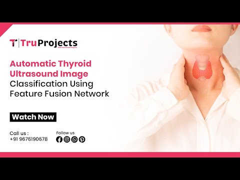 Automatic Thyroid Ultrasound Image Classification Using Feature Fusion Network