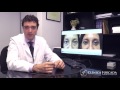 UNA PAUSA CON FORCADA, ¿blefaroplastia con lipofilling? o ¿lipofilling con blefaroplastia?