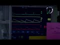 Georges Omalley Est Mort Greys Anatomy 5x24 Georges Omalley Est Mort Greys Anatomy 5x24