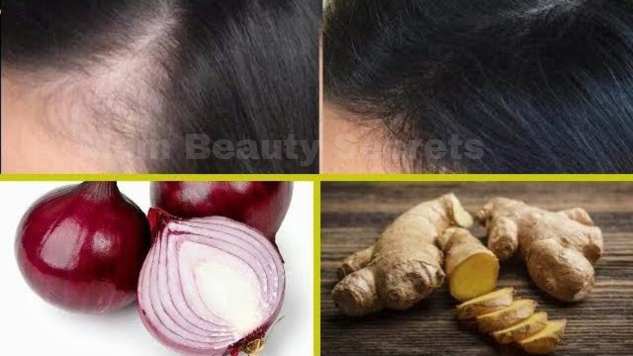 REGROW HAIR WITH ONION & GINGER HAIR MASKDIY MASK FOR EXTREME HAIR