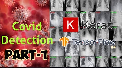 Detecting #COVID-19 from #X-Ray using #Deep Learning - PART-1 #Data Preparation| Training a #CNN