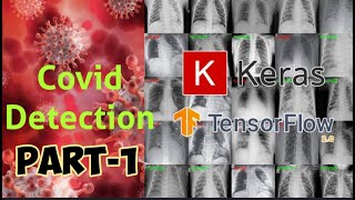 Detecting #COVID-19 from #X-Ray using #Deep Learning - PART-1 #Data Preparation| Training a #CNN