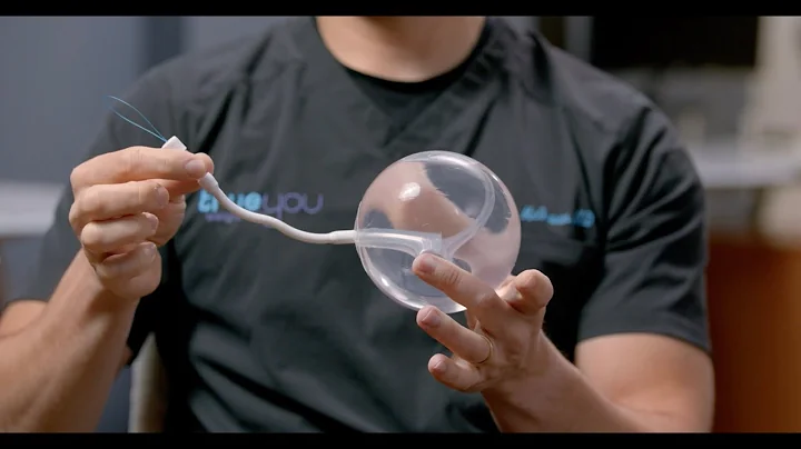 The Spatz3 Adjustable Weight Loss Balloon: An Over...