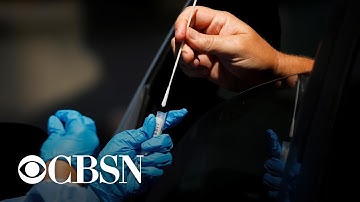 Coronavirus test result delays hobble pandemic response nationwide