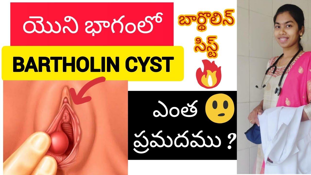 bartholin cyst in telugu Bartholin gland