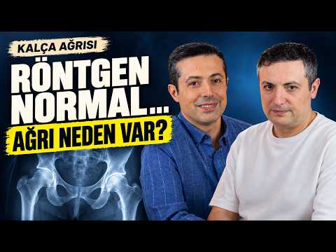 Kalça Ağrısı Neden Geçmiyor? Avasküler Nekroz ve Kireçlenme