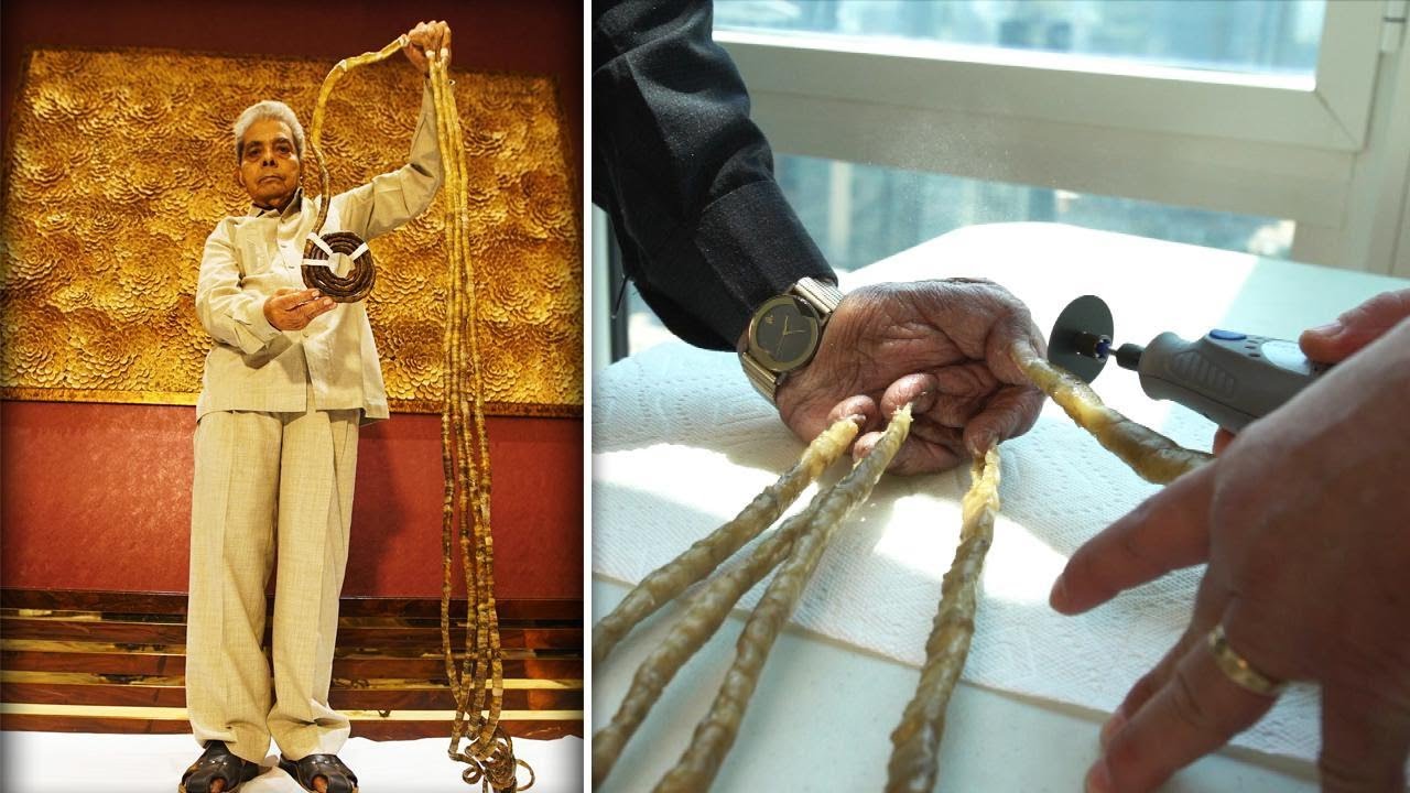 Man with world's longest fingernails cuts them off after 66 years