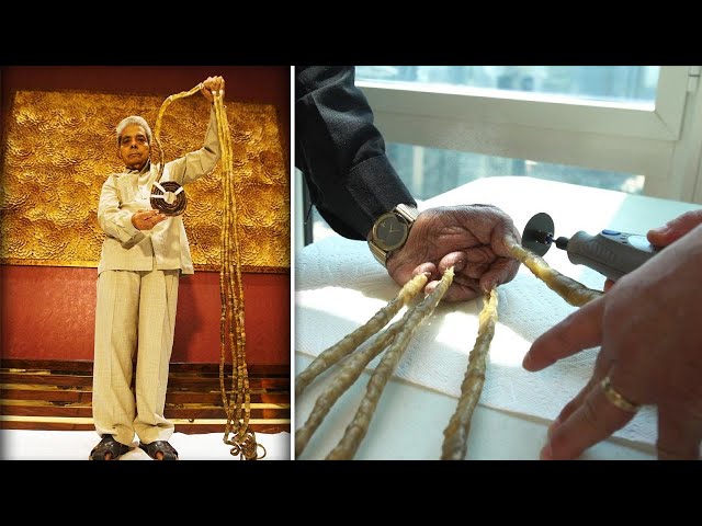 Longest Fingernails On One Hand EVER - Guinness World Records - YouTube