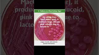 #microbiology #easy #identification #bacteria #klebsiella