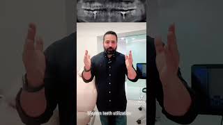 Third Molar Subsuting Lost 1St Molar Without Need To Extract Wisdom Tooth Or Implants