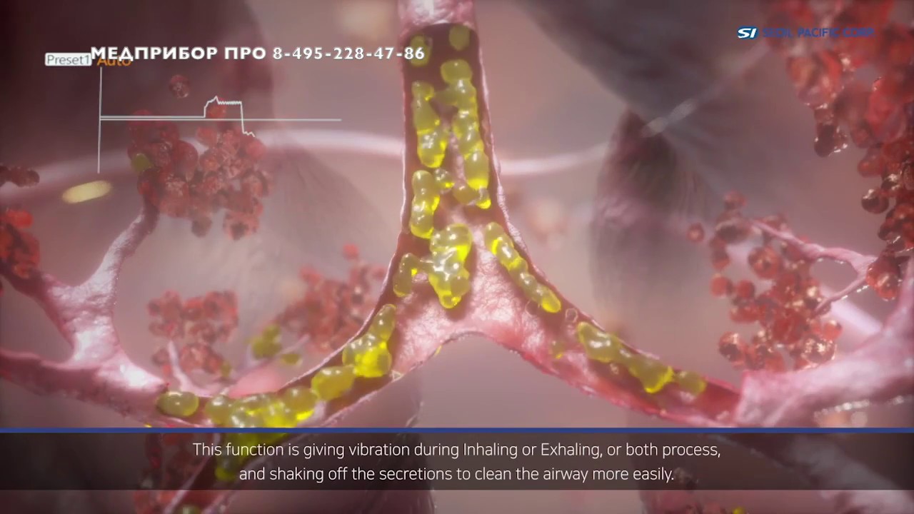 Интрапульмональная перкуссионная вентиляция легких принцип работы (ИПВЛ ...