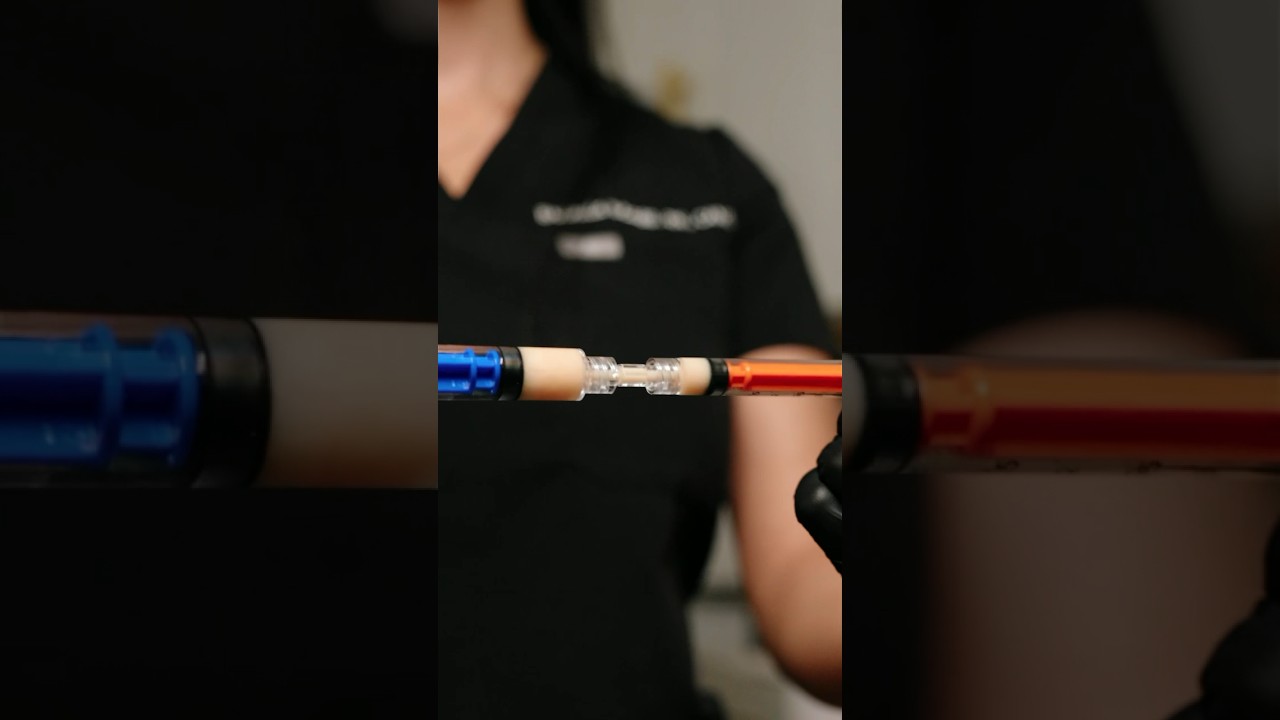 EzgelPRF, your natural alternative to filler. 