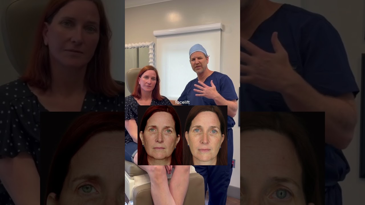 Deep Plane Mini Facelift & Brow Lift Progress Journey