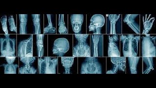 Lecture - X-ray Image Quality and Characteristics - Radiographic Physics