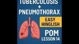 Tuberculosis (TB) + Pneumothorax Explained | Davidson Lesson 14 | POM BHMS MBBS FMG | Easy Hinglish