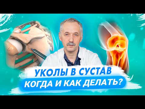 Уколы в сустав. Когда и как делать? Все, что нужно знать / Доктор Виктор