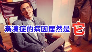 Download Lagu 900人小鎮竟有十幾名漸凍症患者,科學家研究10年,終於有了驚人發現! MP3 Download Lagu 900人小鎮竟有十幾名漸凍症患者,科學家研究10年,終於有了驚人發現! MP3