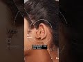 Otoplasty – Reshape & Enhance Your Ears for a Balanced Look! 👂✨