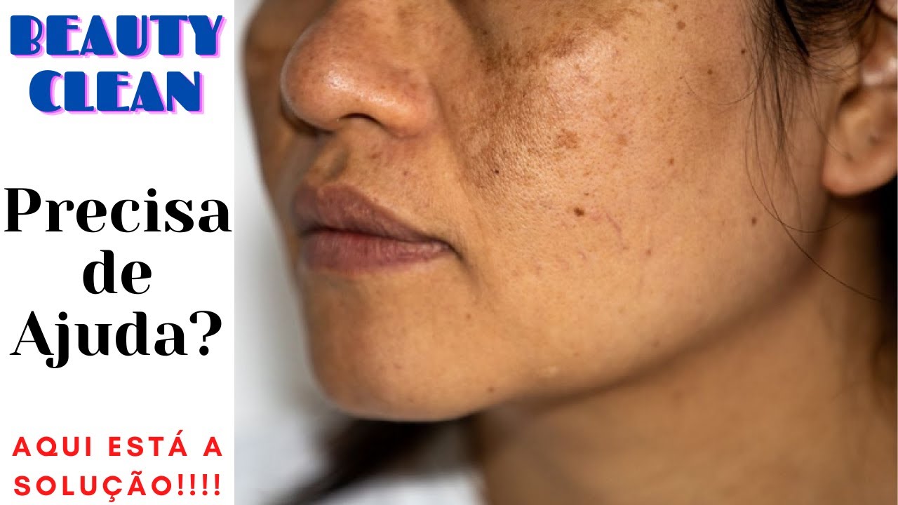 Beauty Clean Funciona Mesmo? Vale a Pena? Como Usar? Veja Esse Vídeo!