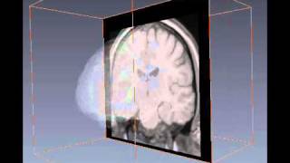 Brain MRI Segment