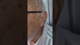 Audífonos para sordera