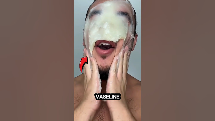 Stop Using Too Much Vaseline On Your Face!