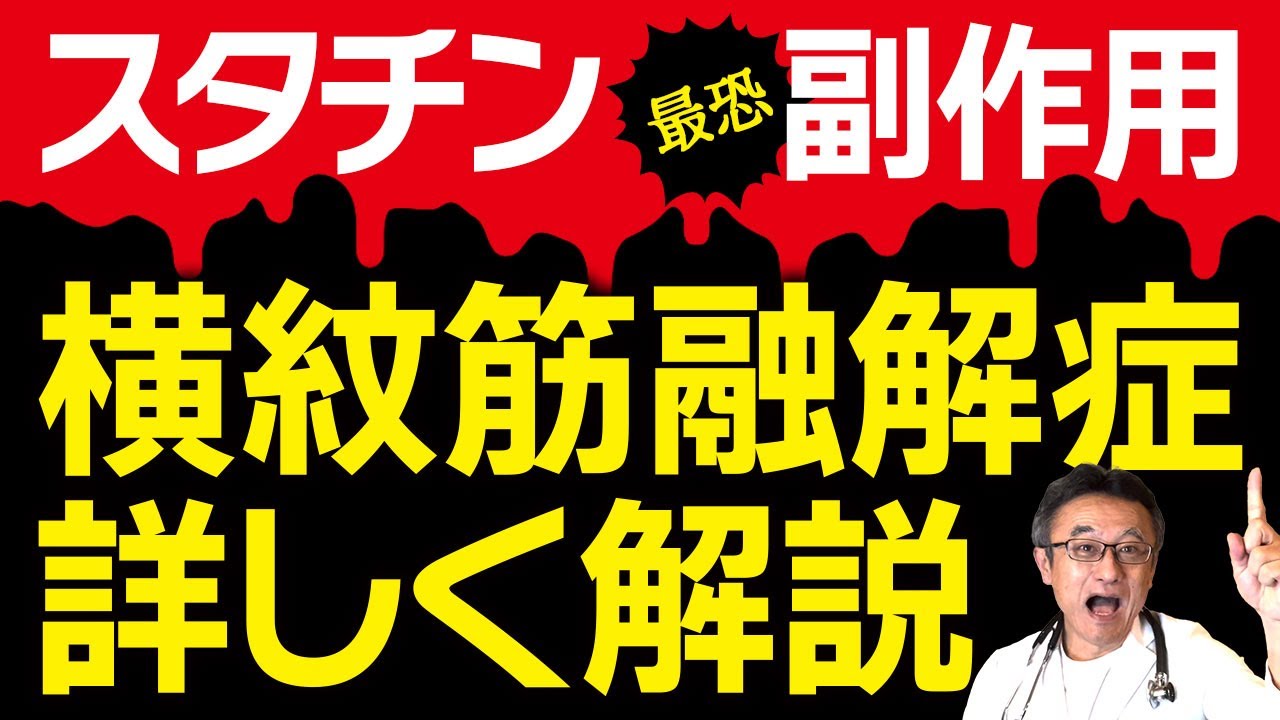 【スタチン副作用】横紋筋融解症は本当に危険？循環器内科医が徹底解説