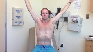 Shoulder exam - Drop arm test