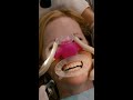 This is 40 | Dentist Scene