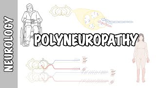 Approach to Polyneuropathy  causes, pathophysiology, investigations