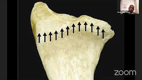 Distal Radius Fractures. Ain Shams orthopedic webinar