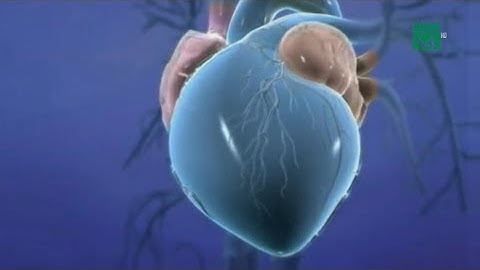 Điều trị rung nhĩ bằng phương pháp mới| VTC14