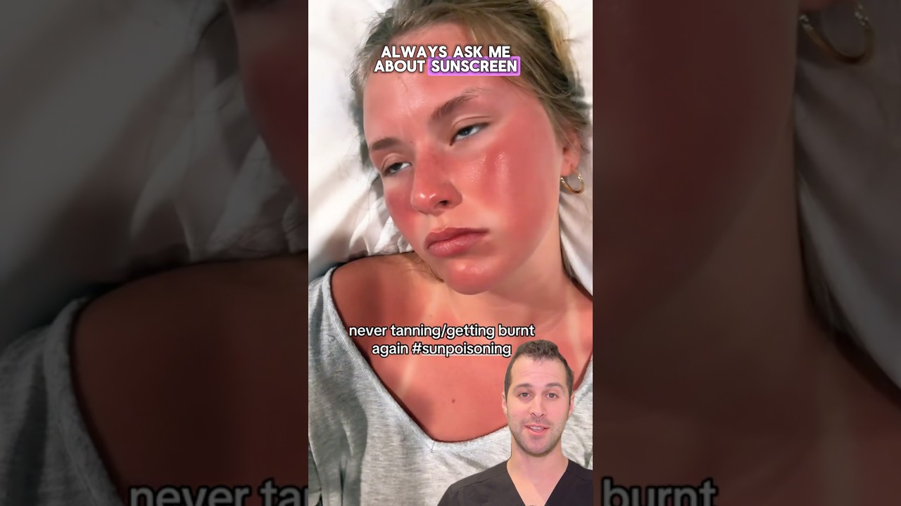 How To Stop Sunburns