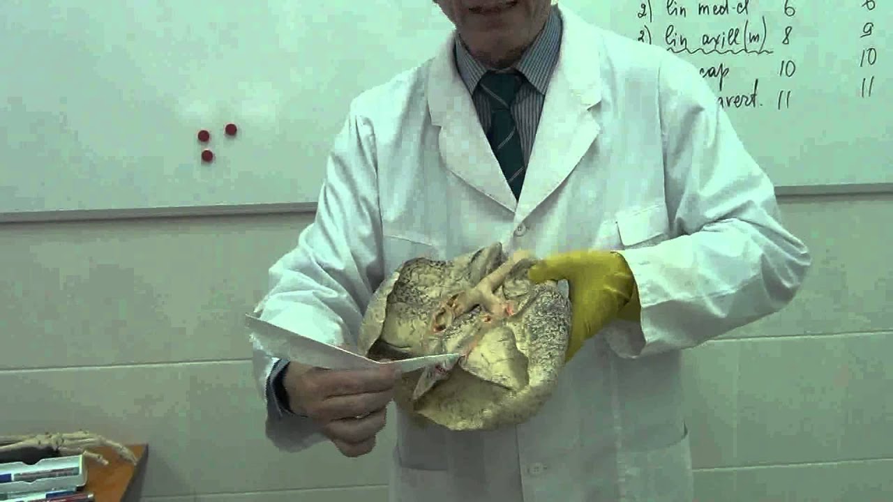 Легкие, плевра Рисунок на доске и препараты