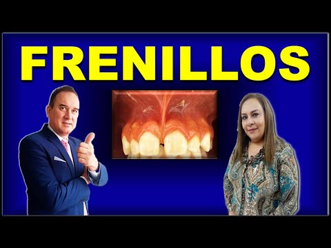 LIP FRENULUM LINGUAL FRENULUM (INSERT FRENULUMS IN ORAL CAVITY)