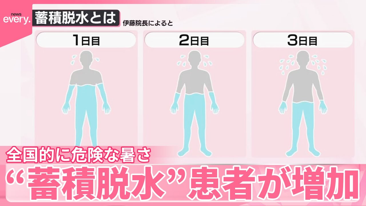 【気づきにくい“蓄積脱水”】全国的に危険な暑さ続く中…患者が増加