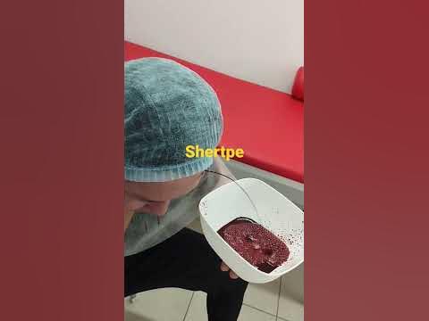 Кровопускание из лбы. 4 часть - YouTube