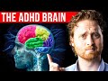 How The ADHD Brain Works