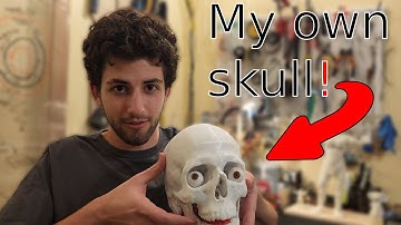 Printing My Own Body Parts in 3D!