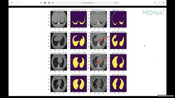 MONAI Bootcamp 2021  - MONAI Core - Image Registration