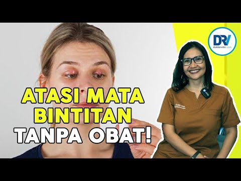 Video: Cara Menghilangkan Bintitan: 11 Langkah (dengan Gambar)