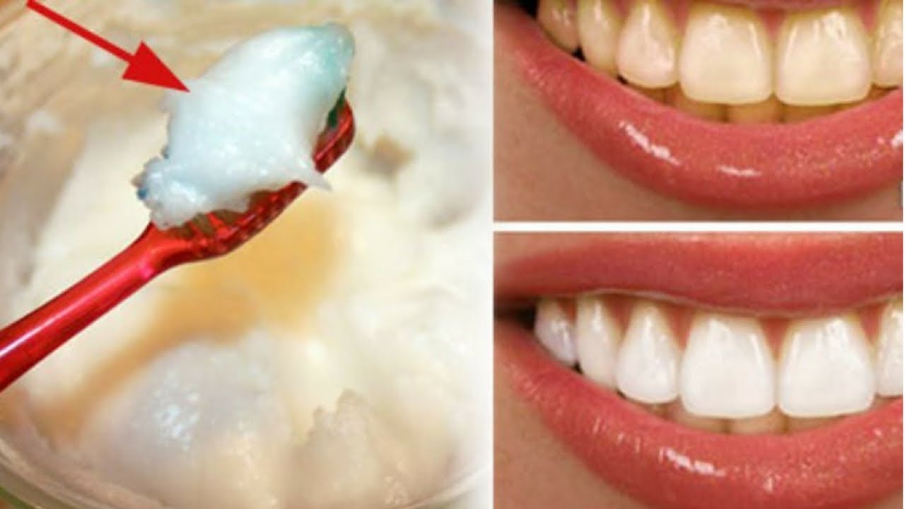 How I Whiten My Teeth At Home Teeth Whitening 4 You clickbank