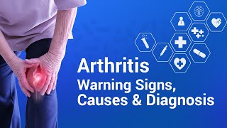 Arthritis: Warning Signs, Causes & Diagnosis screenshot 5