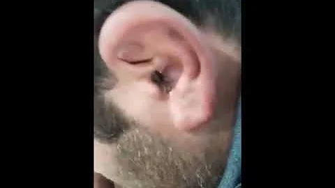 ЖЕСТЬ!!!СКОЛОПЕНДРА В УХЕ|TIN !!! SCOLOPENDRA IN THE EAR