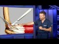 Tennis Elbow Surgery